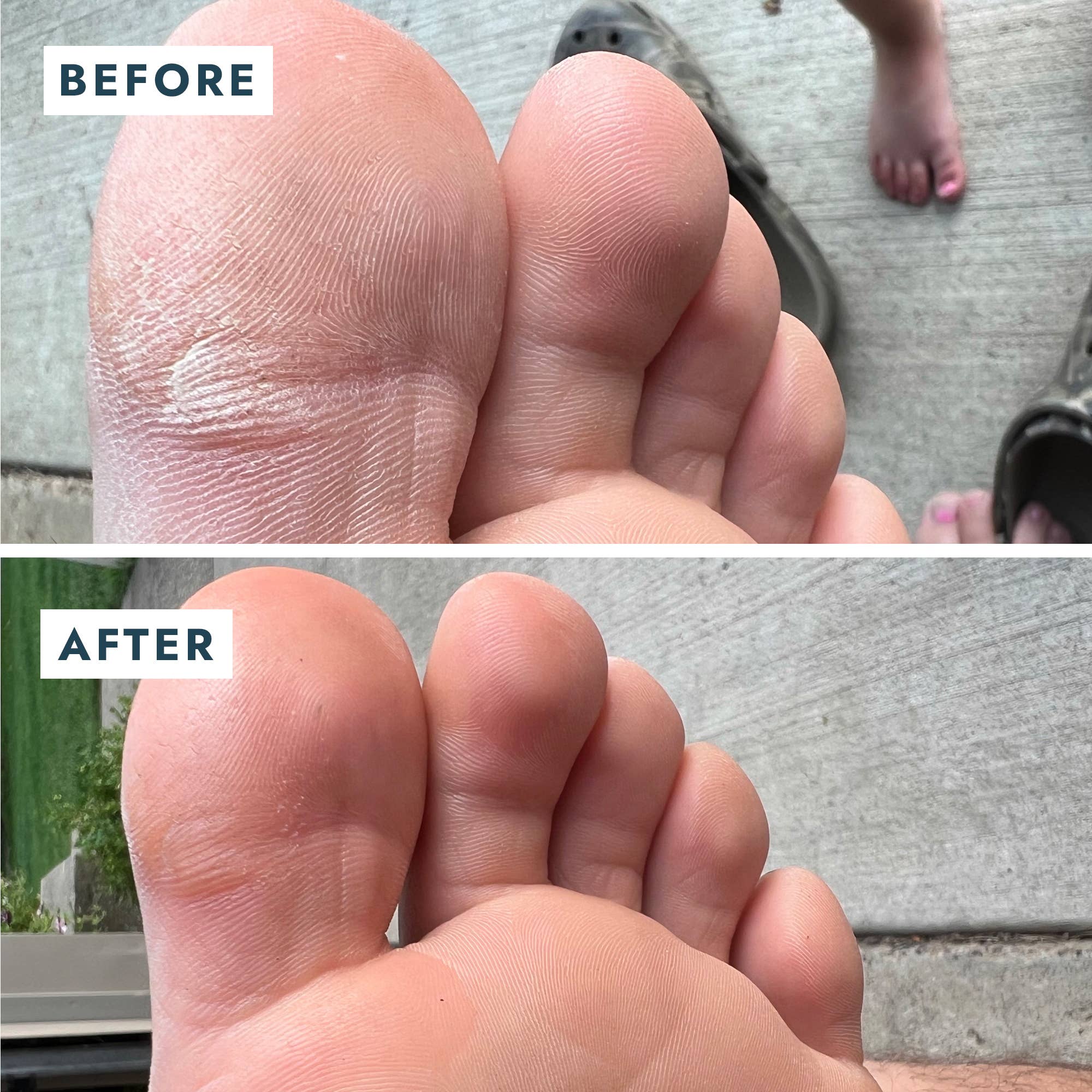 VOESH New York - Solemate Heel Repair Balm Retail - Mint