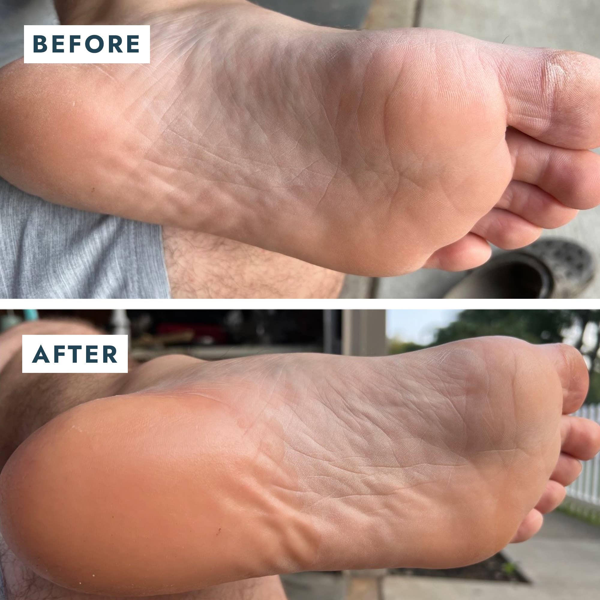 VOESH New York - Solemate Heel Repair Balm Retail - Mint