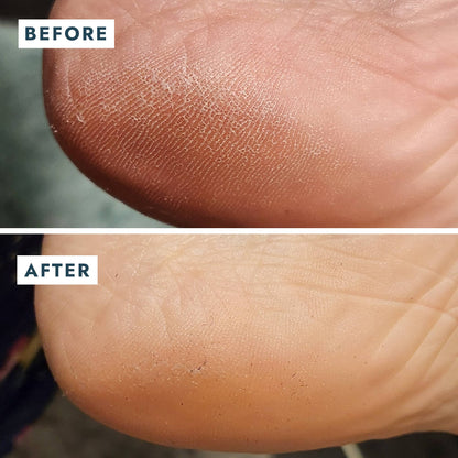 VOESH New York - Solemate Heel Repair Balm Retail - Mint