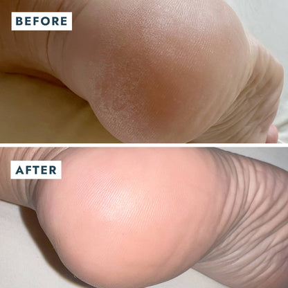 VOESH New York - Solemate Heel Repair Balm Retail - Mint